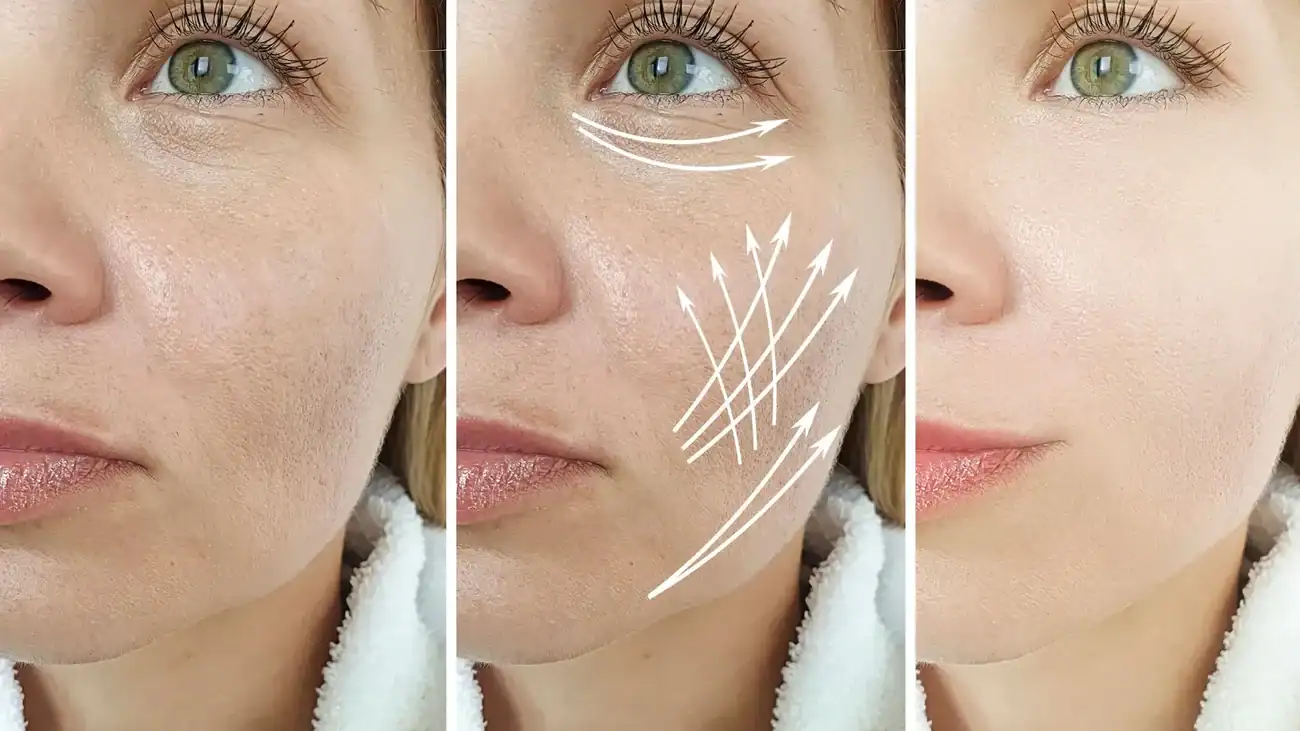 Can One Treatment Really Tackle More Than One Skin Concern Tewkesbury?