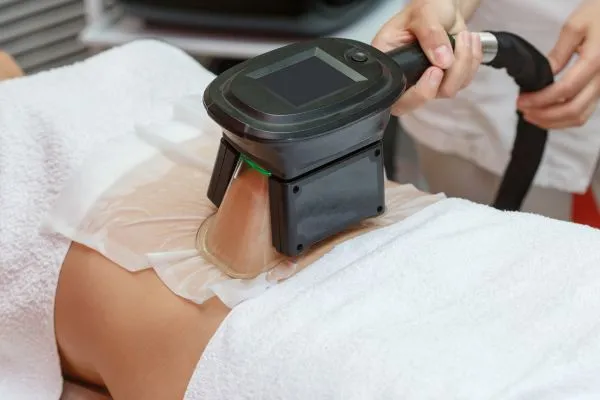 Image of person having fat freezing treatment to help weight gain Tewkesbury