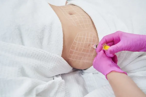 image of fat dissolving injections on love handles to help combat weight gain Tewkesbury