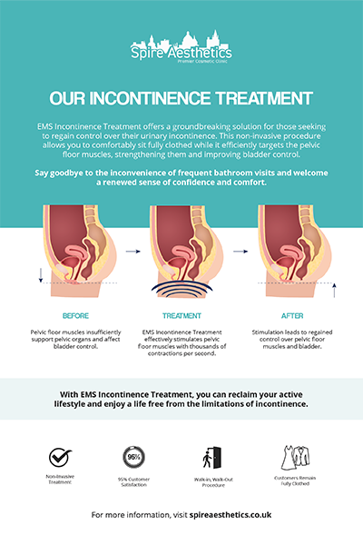 image to show how EMS treatment works for female urinary incontinence Tewkesbury