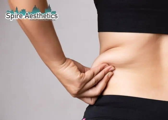 Image of woman pinching fat on their hips Tewkesbury. Fat Freezing treatment