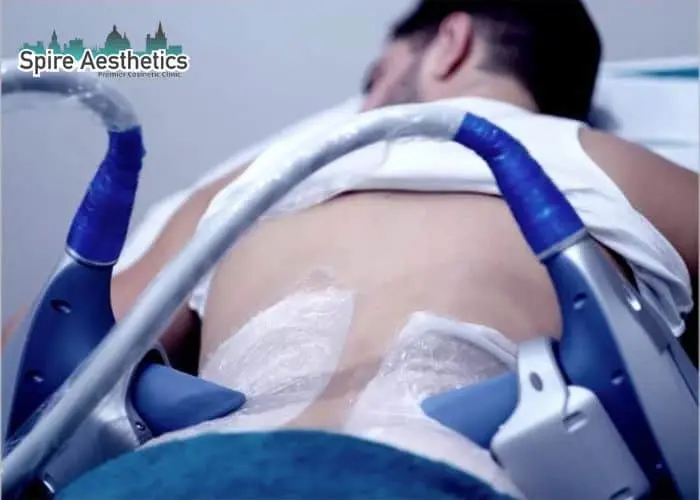 Man having fat freezing treatment done on love handles before a competitions Tewkesbury to create a sculpted look.