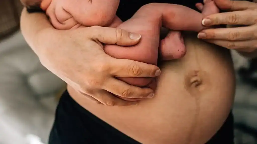 Why Is My Stomach Still Big After Pregnancy Tewkesbury?